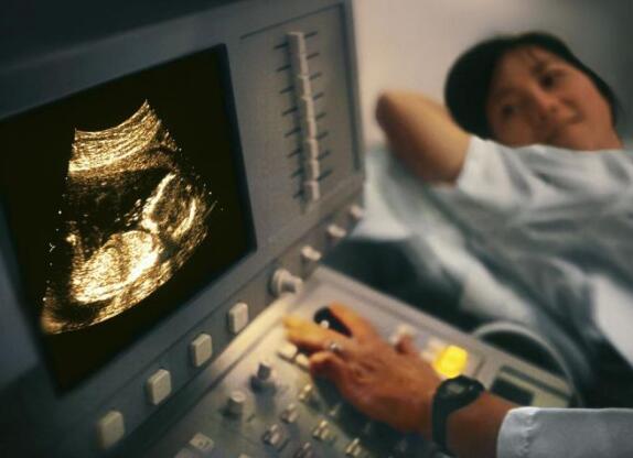 怀孕做b超检查要多少钱?图片