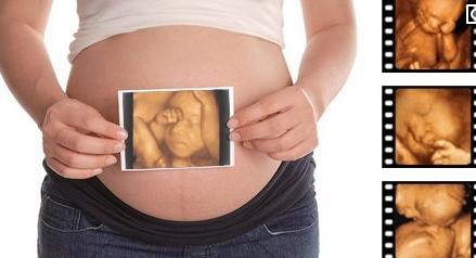 怀孕六个月可以做四维彩超吗?图片