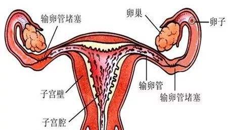 女性不孕输卵管检查要做什么？有什么注意事项？图片