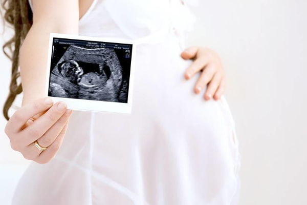 B超预测男女怀孕16周的准确率是多少图片