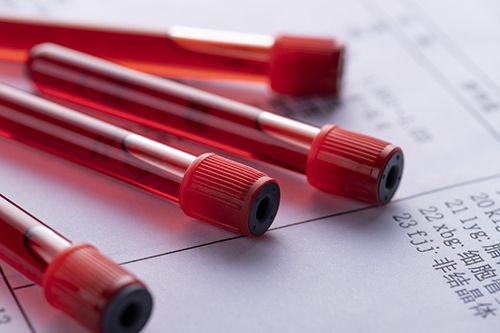 血常规检查项目是什么？孕妇血常规检查项目有哪些？图片