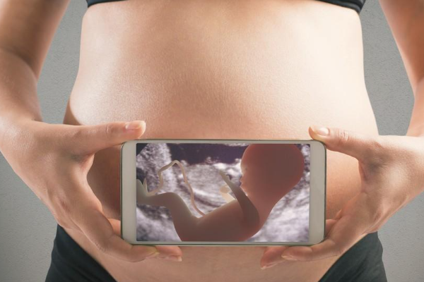 孕16周彩色多普勒超声是否能准确判断胎儿性别吗?图片
