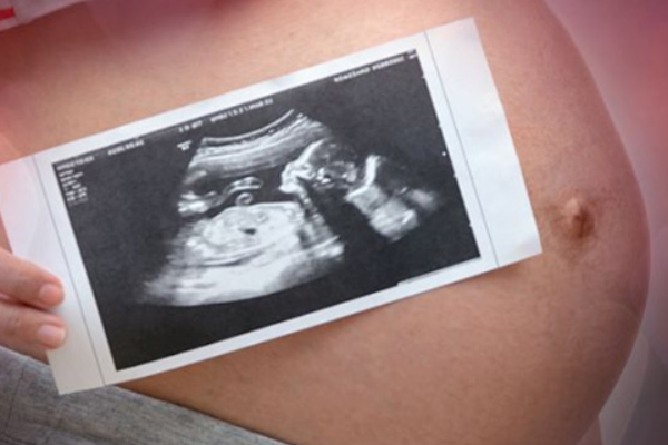 B超能看男女怀孕16周吗 孕晚期b超名单上男女的暗示是什么图片