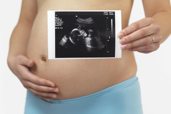 怀孕16周彩色多普勒超声检查胎儿性别准确吗?图片