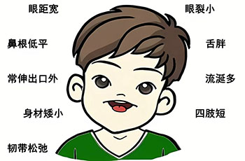 香港无创是否能筛查出唐氏儿？图片