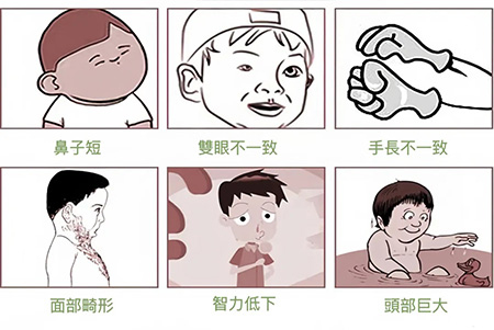 面对无创与羊穿，高龄孕妈如何选？图片